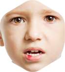 Cut or bitten tooth treatment kerala