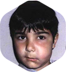 Treatment for abscess in children kerala